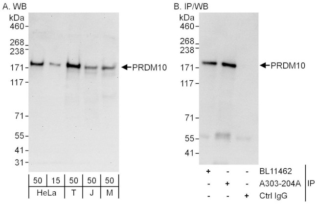 PRDM10 Antibody in Western Blot (WB)
