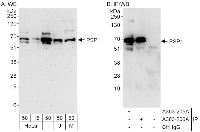 PSP1 Antibody in Western Blot (WB)