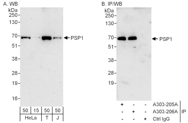 PSP1 Antibody in Western Blot (WB)