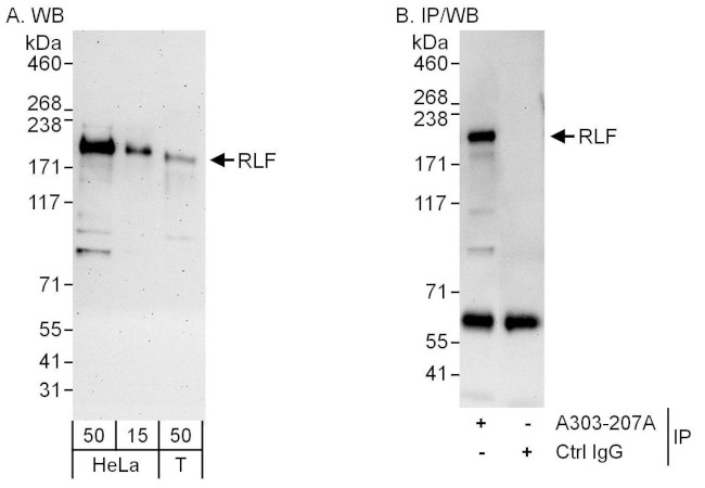 RLF Antibody in Western Blot (WB)