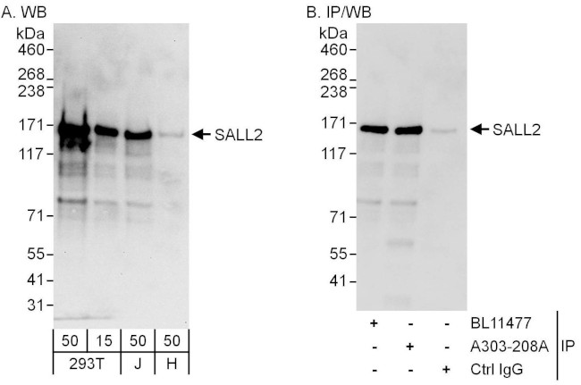 SALL2 Antibody in Western Blot (WB)