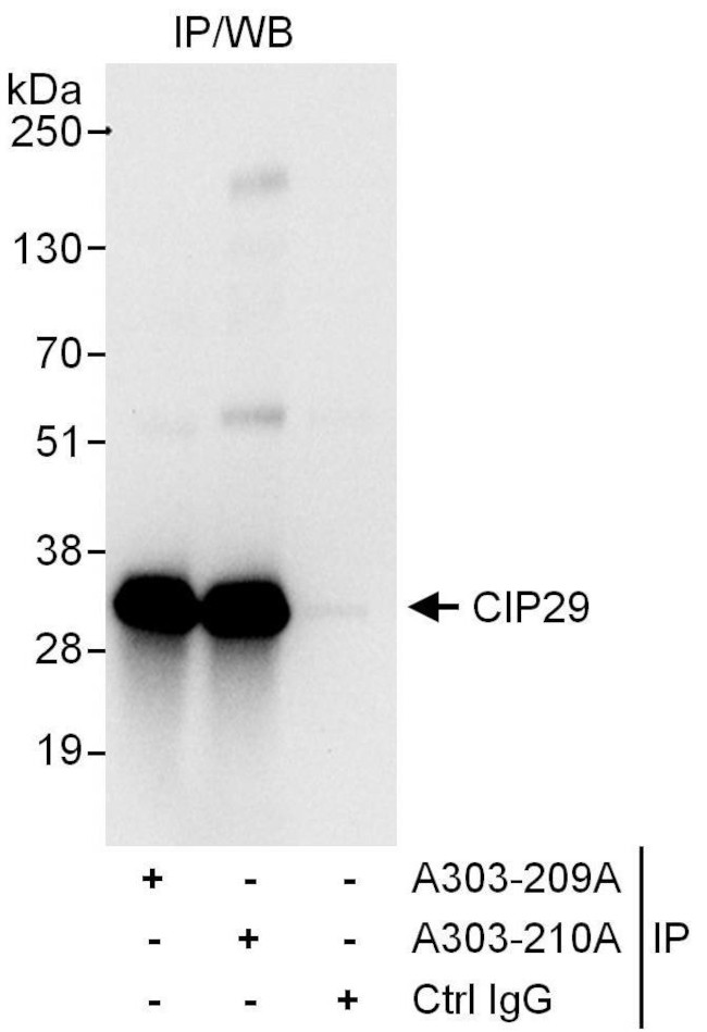 CIP29 Antibody in Immunoprecipitation (IP)