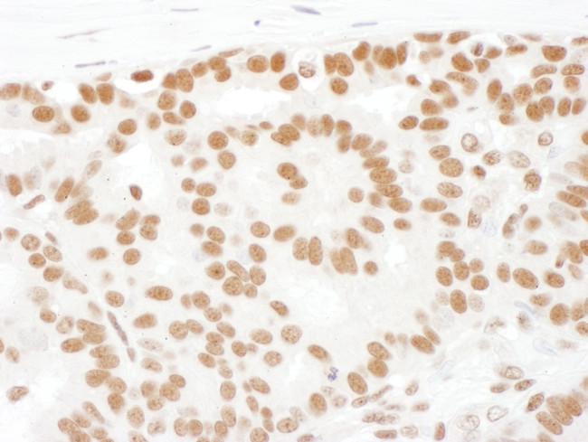 SF1 Antibody in Immunohistochemistry (Paraffin) (IHC (P))