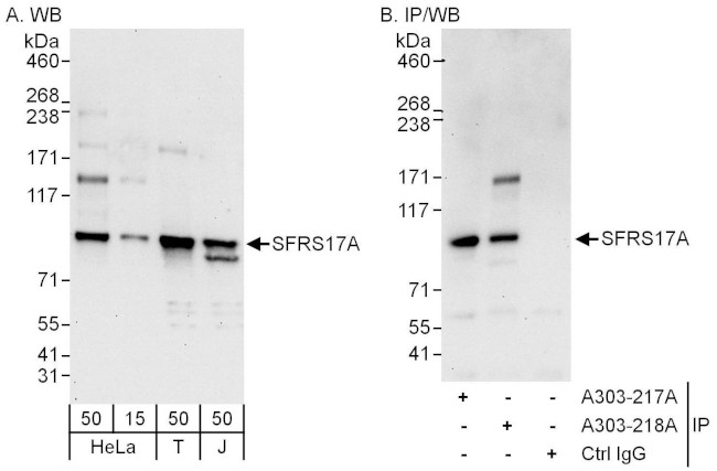 SFRS17A Antibody in Western Blot (WB)