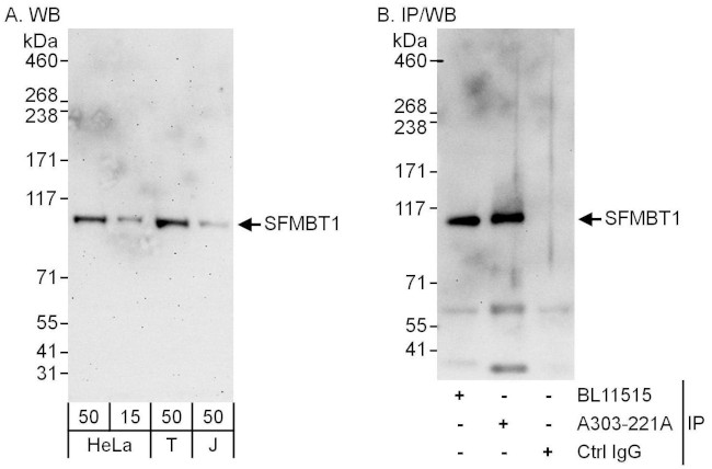 SFMBT1 Antibody in Western Blot (WB)