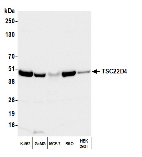 TSC22D4 Antibody in Western Blot (WB)
