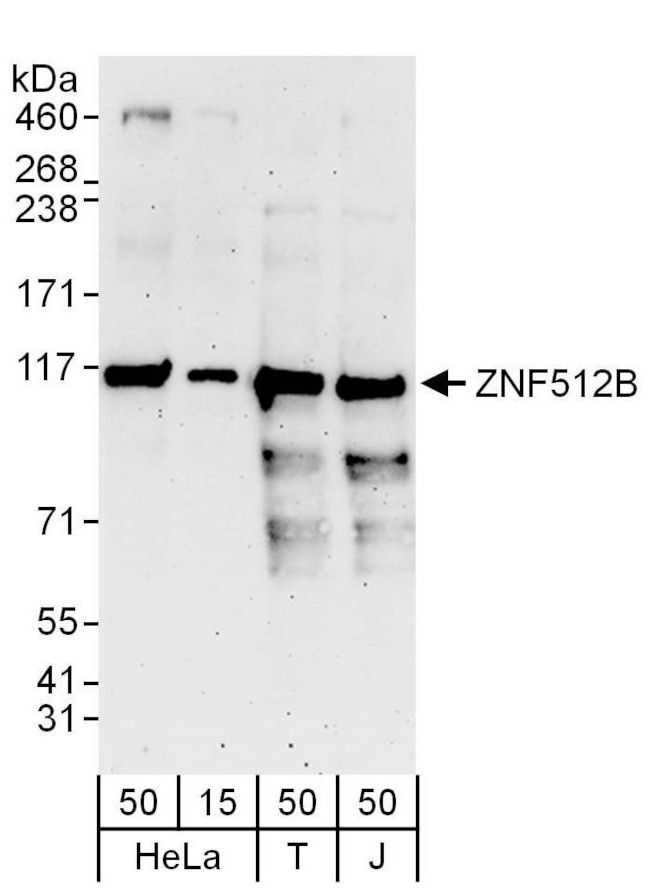 ZNF512B Antibody in Western Blot (WB)