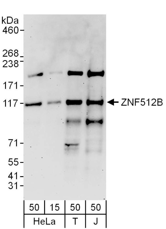 ZNF512B Antibody in Western Blot (WB)