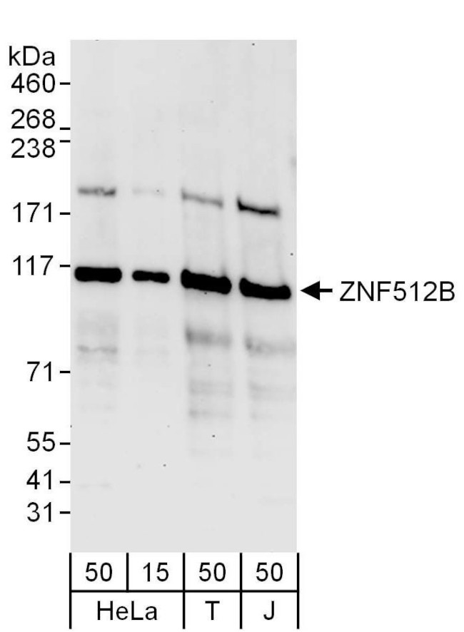 ZNF512B Antibody in Western Blot (WB)