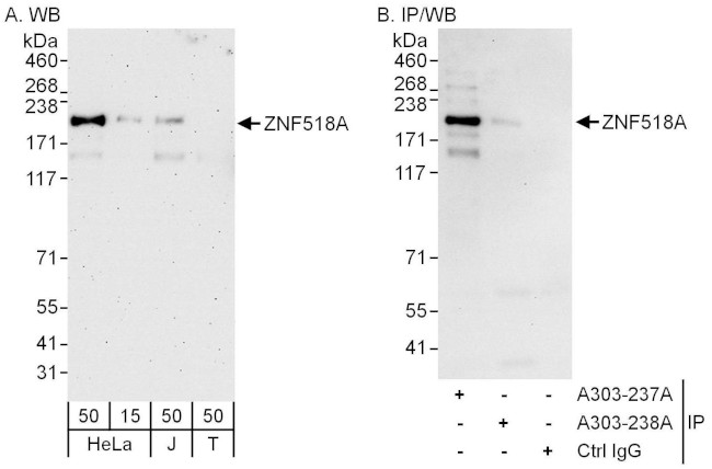 ZNF518A Antibody in Western Blot (WB)