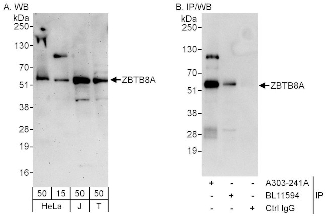 ZBTB8A Antibody in Western Blot (WB)