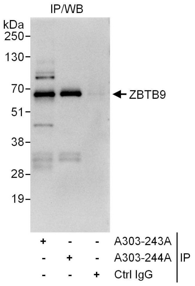 ZBTB9 Antibody in Immunoprecipitation (IP)