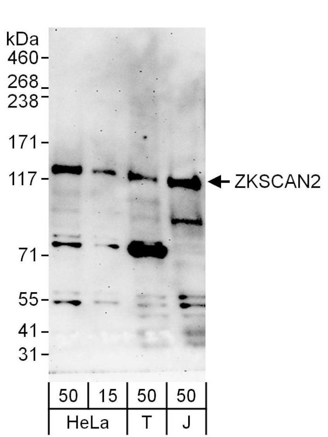 ZKSCAN2 Antibody in Western Blot (WB)
