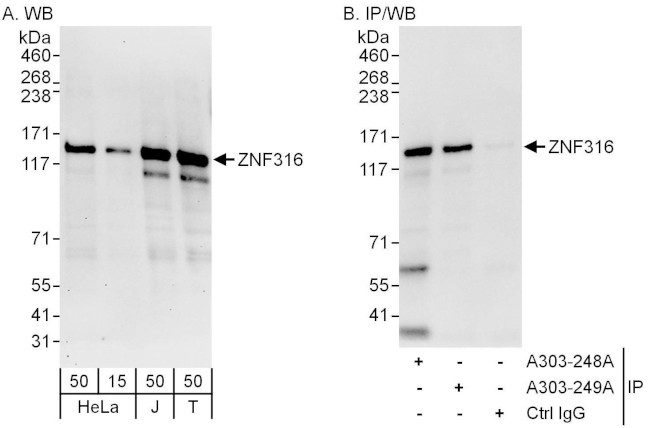 ZNF316 Antibody in Western Blot (WB)