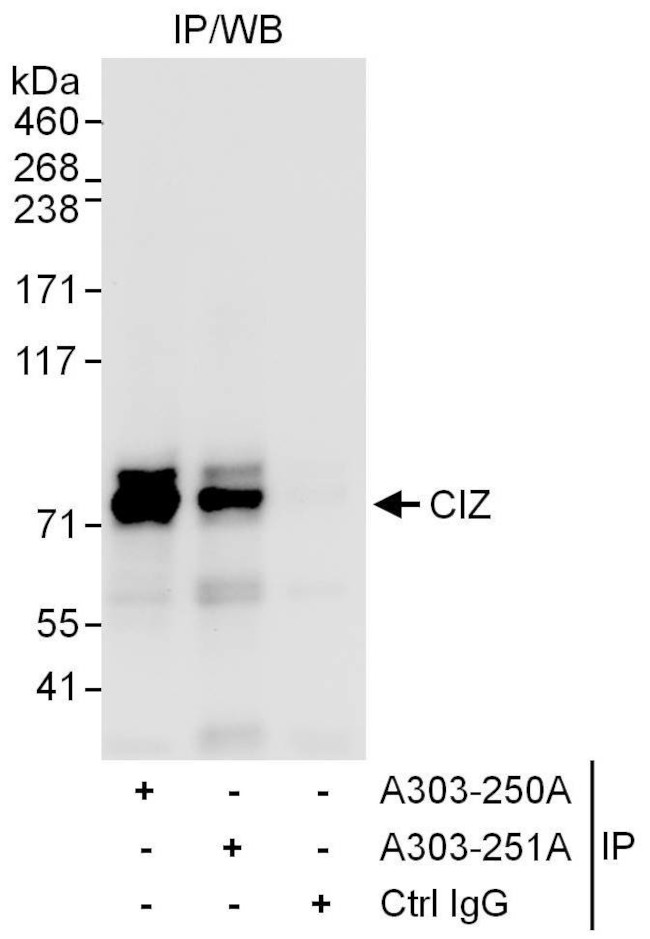 CIZ Antibody in Immunoprecipitation (IP)