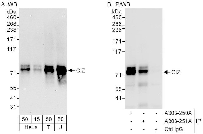 CIZ Antibody in Western Blot (WB)