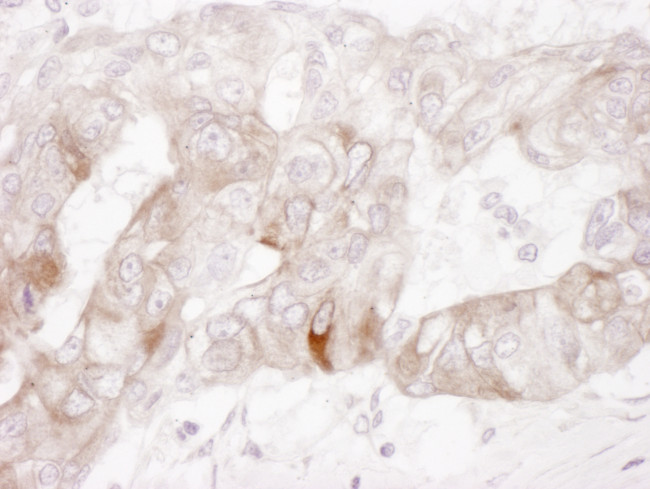 c-Kit Antibody in Immunohistochemistry (Paraffin) (IHC (P))
