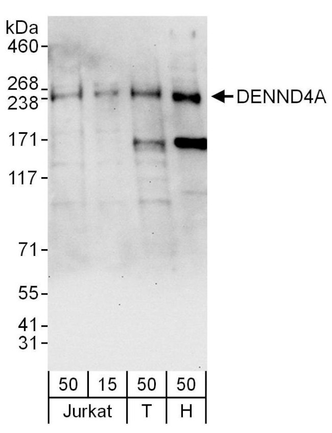 DENND4A Antibody in Western Blot (WB)