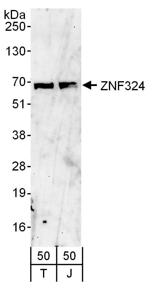 ZNF324 Antibody in Western Blot (WB)