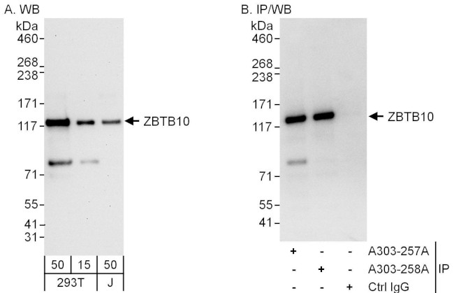 ZBTB10 Antibody in Western Blot (WB)