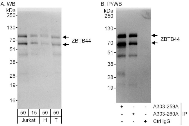 ZBTB44 Antibody in Western Blot (WB)