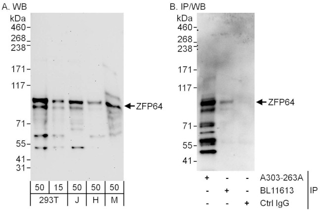 ZFP64 Antibody in Western Blot (WB)