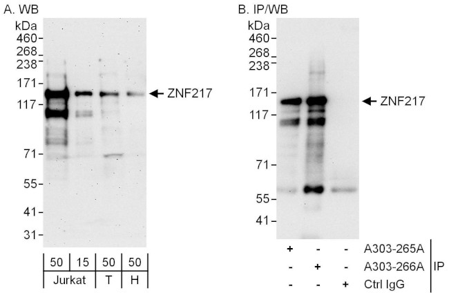 ZNF217 Antibody in Western Blot (WB)