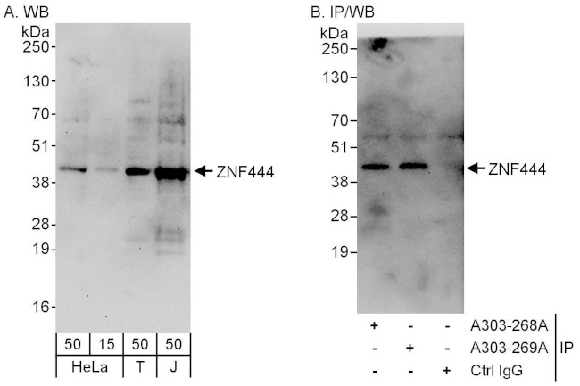 ZNF444 Antibody in Western Blot (WB)