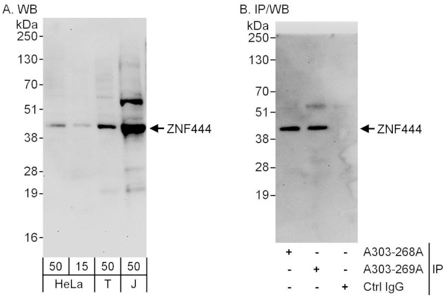 ZNF444 Antibody in Western Blot (WB)