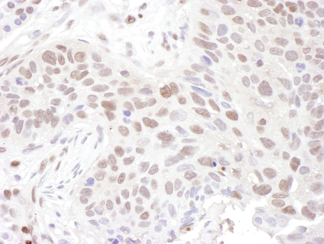 ZNF462 Antibody in Immunohistochemistry (Paraffin) (IHC (P))