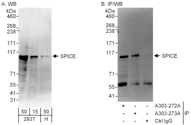 SPICE Antibody in Western Blot (WB)