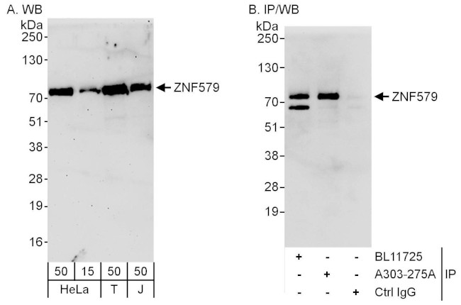 ZNF579 Antibody in Western Blot (WB)