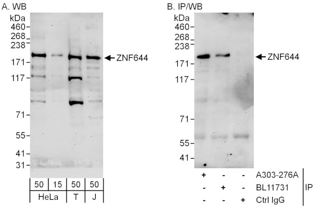 ZNF644 Antibody in Western Blot (WB)