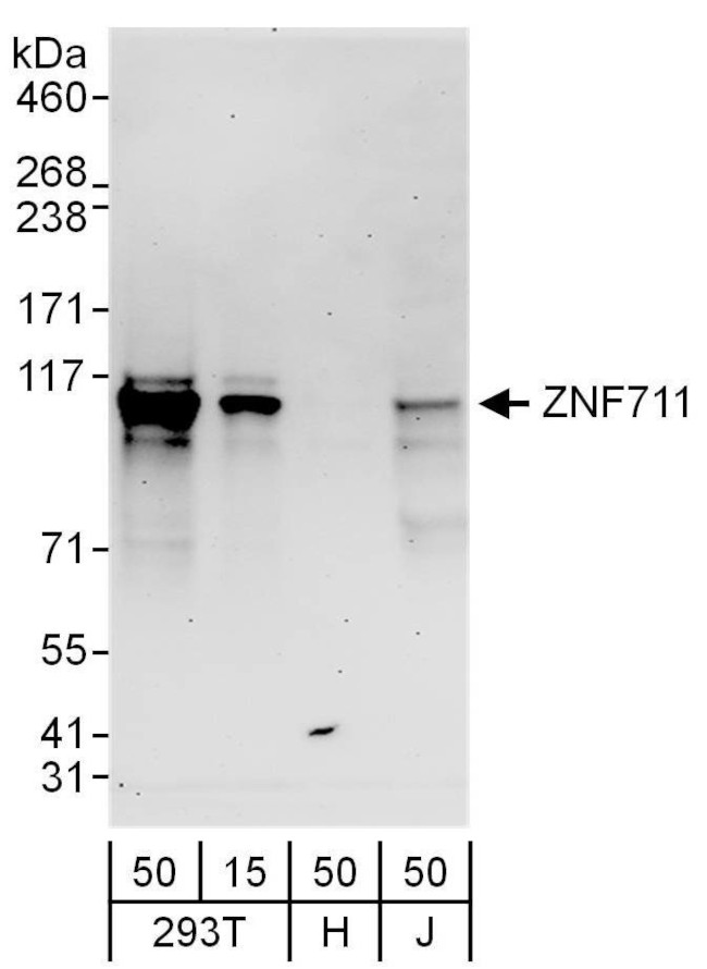 ZNF711 Antibody in Western Blot (WB)