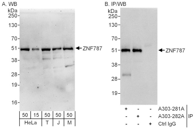 ZNF787 Antibody in Western Blot (WB)