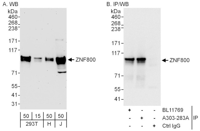 ZNF800 Antibody in Western Blot (WB)