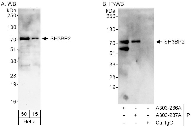 SH3BP2 Antibody in Western Blot (WB)