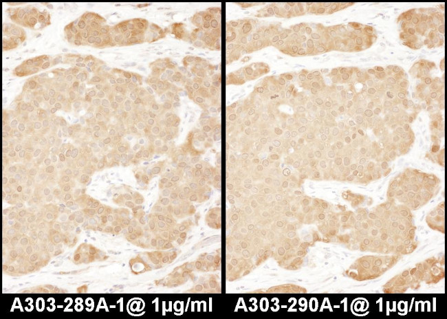 LASP1 Antibody in Immunohistochemistry (Paraffin) (IHC (P))