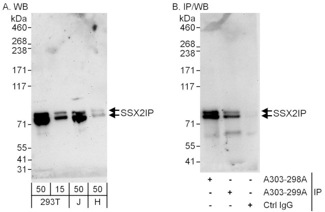 SSX2IP Antibody in Western Blot (WB)