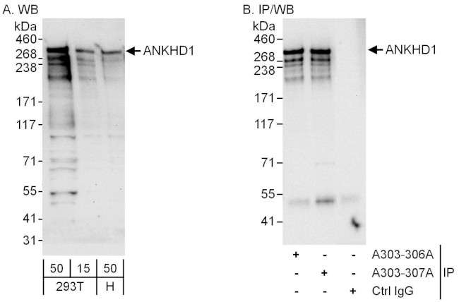 ANKHD1 Antibody in Western Blot (WB)