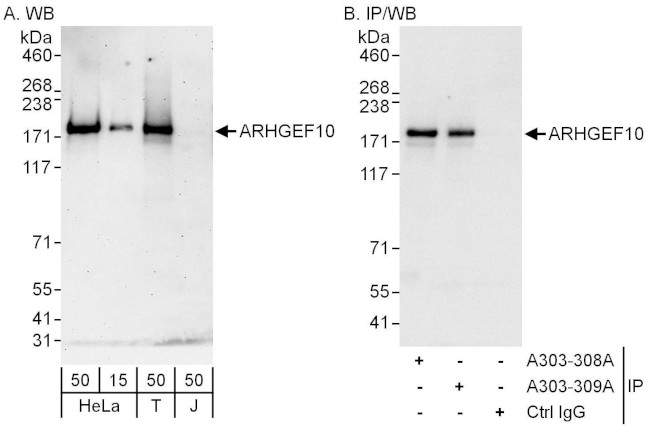 ARHGEF10 Antibody in Western Blot (WB)