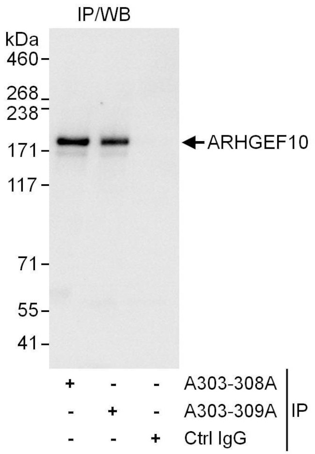 ARHGEF10 Antibody in Immunoprecipitation (IP)