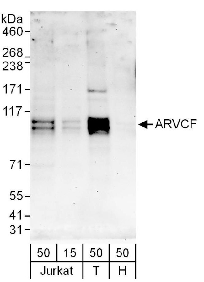 ARVCF Antibody in Western Blot (WB)