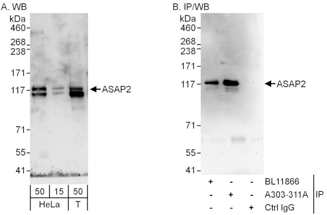 ASAP2 Antibody in Western Blot (WB)