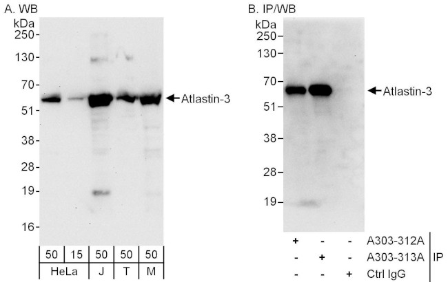Atlastin-3 Antibody in Western Blot (WB)