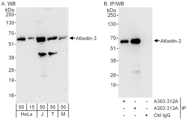 Atlastin-3 Antibody in Western Blot (WB)