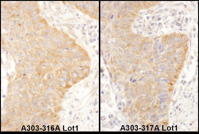 IGF2BP2 Antibody in Immunohistochemistry (Paraffin) (IHC (P))