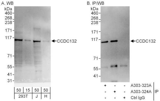 CCDC132 Antibody in Western Blot (WB)