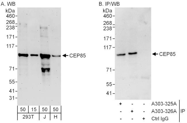 CEP85 Antibody in Western Blot (WB)