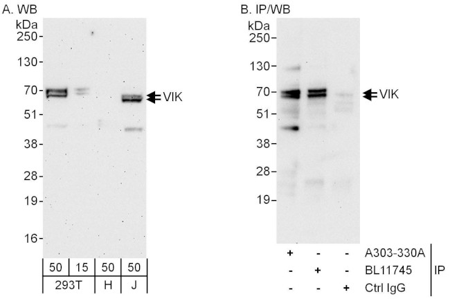 VIK Antibody in Western Blot (WB)